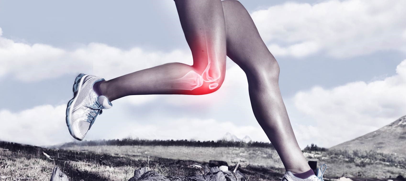 knee pain arthritis doctor