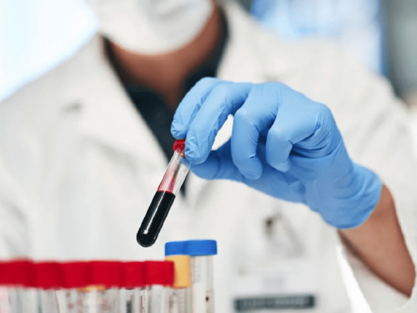 regenmedicine PRP Orthopedic Doctor Fairfax VA